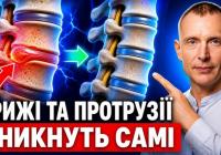 Зворотний процес: як правильні вправи здатні вилікувати остеохондроз, протрузії та грижі хребта